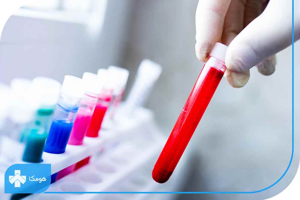 ferritin چیست