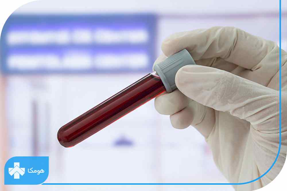 عوارض غلظت خون در آزمایش چیست