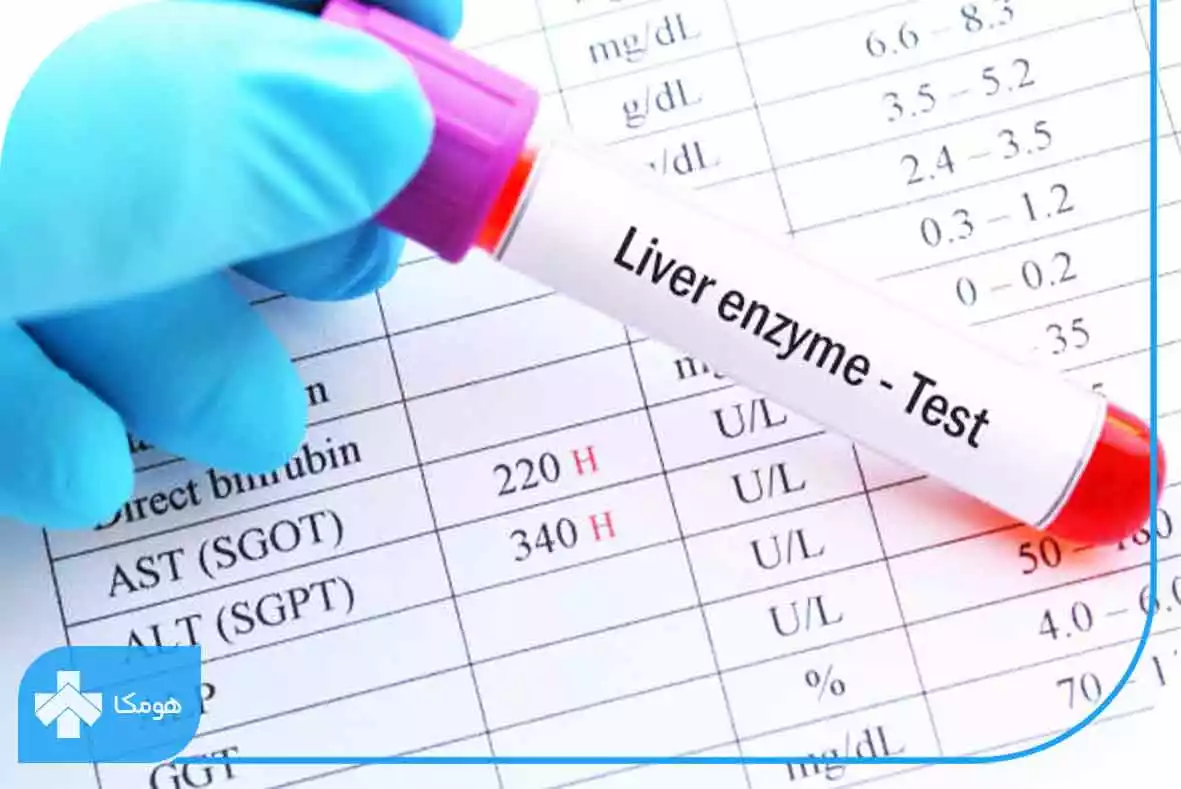 sgot در آزمایش خون چیست