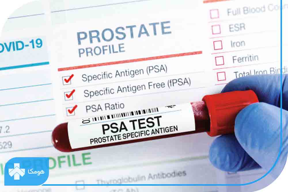 تست غربالگری پروستات