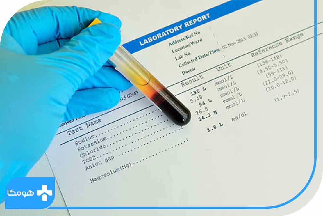 میزان نرمال و بحرانی سدیم در آزمایش خون