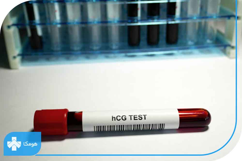 آزمایش خون تشخیص بارداری