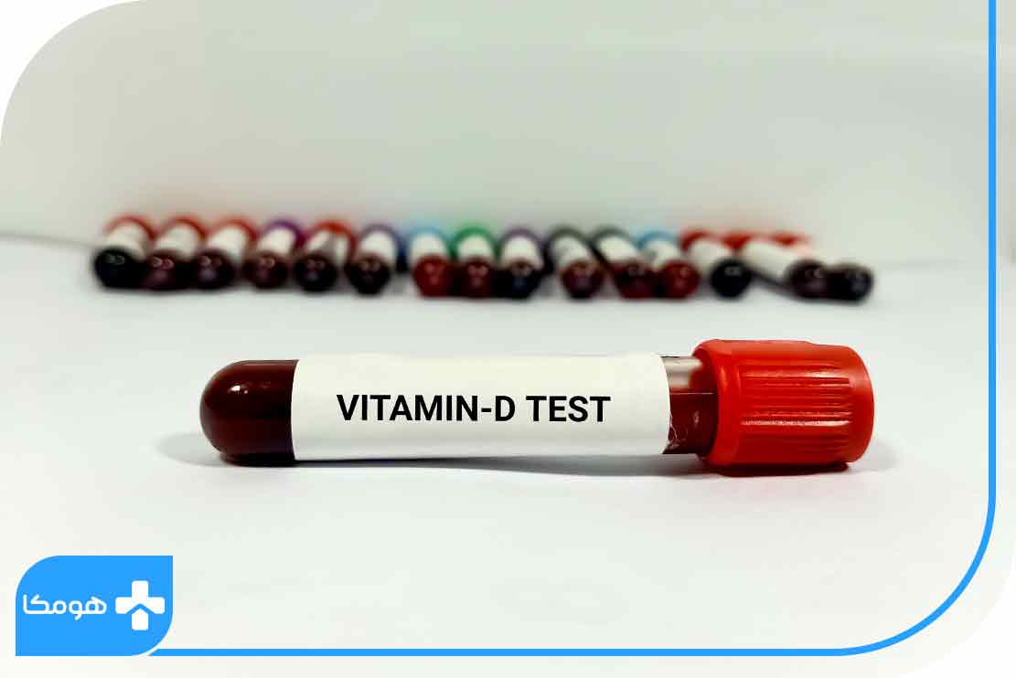 کلسیم در آزمایش خون و ویتامین دی