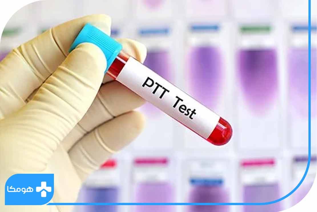آزمایش PTT چیست