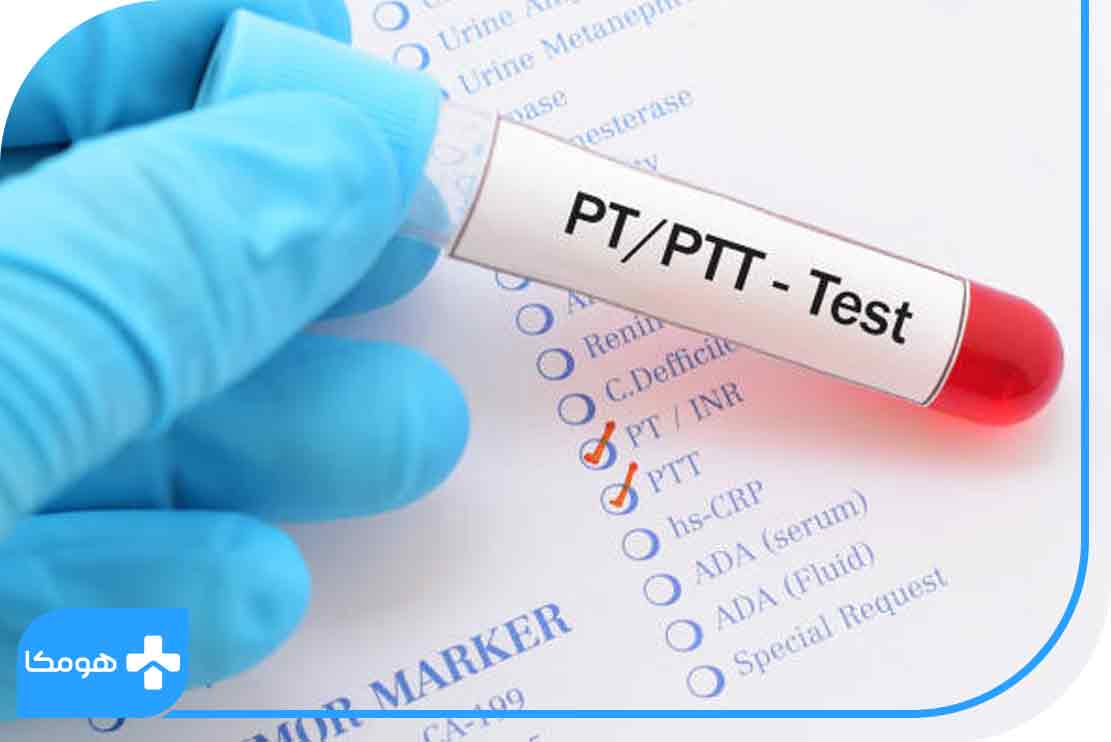 تست های مرتبط با آزمایش PTT