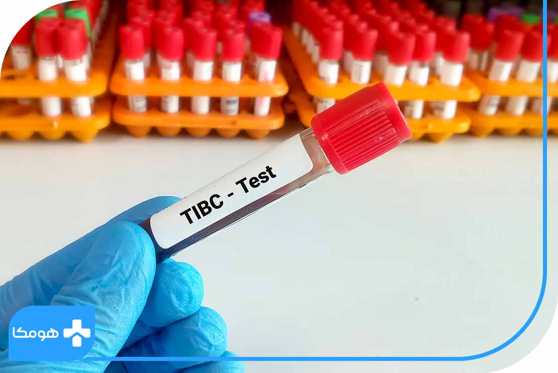 آزمایش TIBC چیست؟