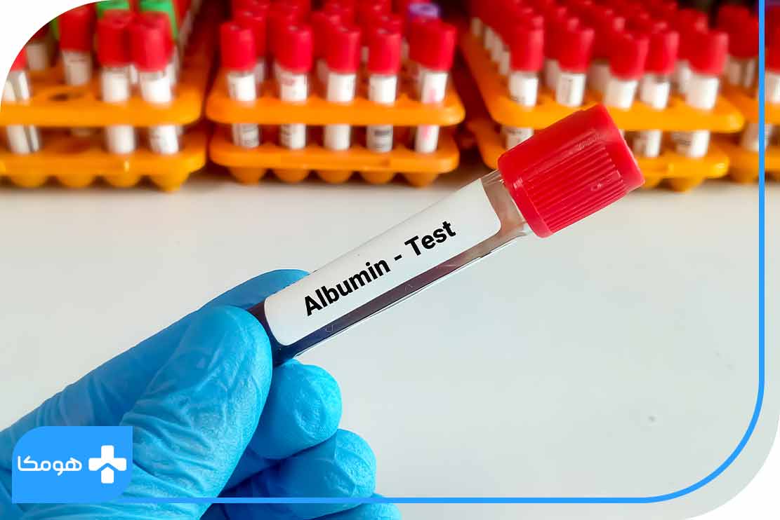آلبومین در آزمایش خون