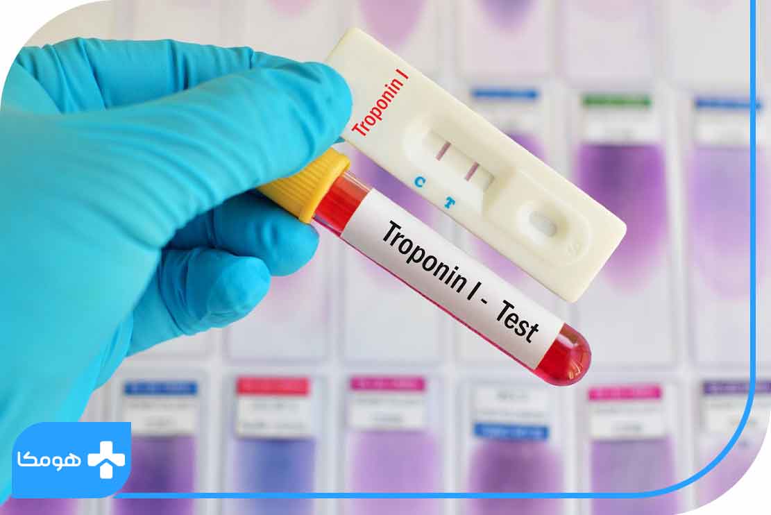 آزمایش Troponin