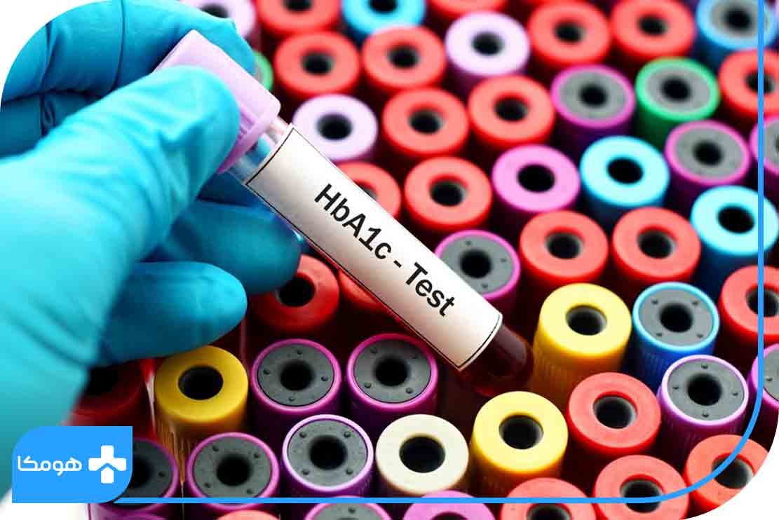 نشانه‌های بالا بودن HbA1C در آزمایش خون