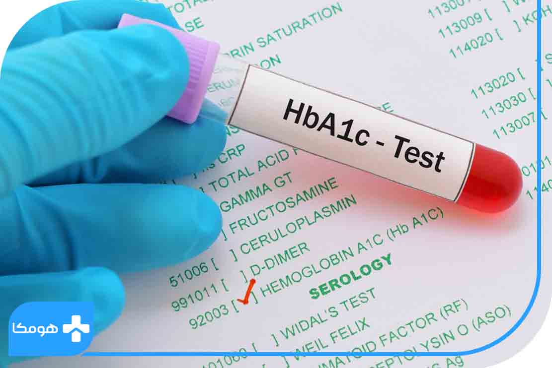 تست HbA1C