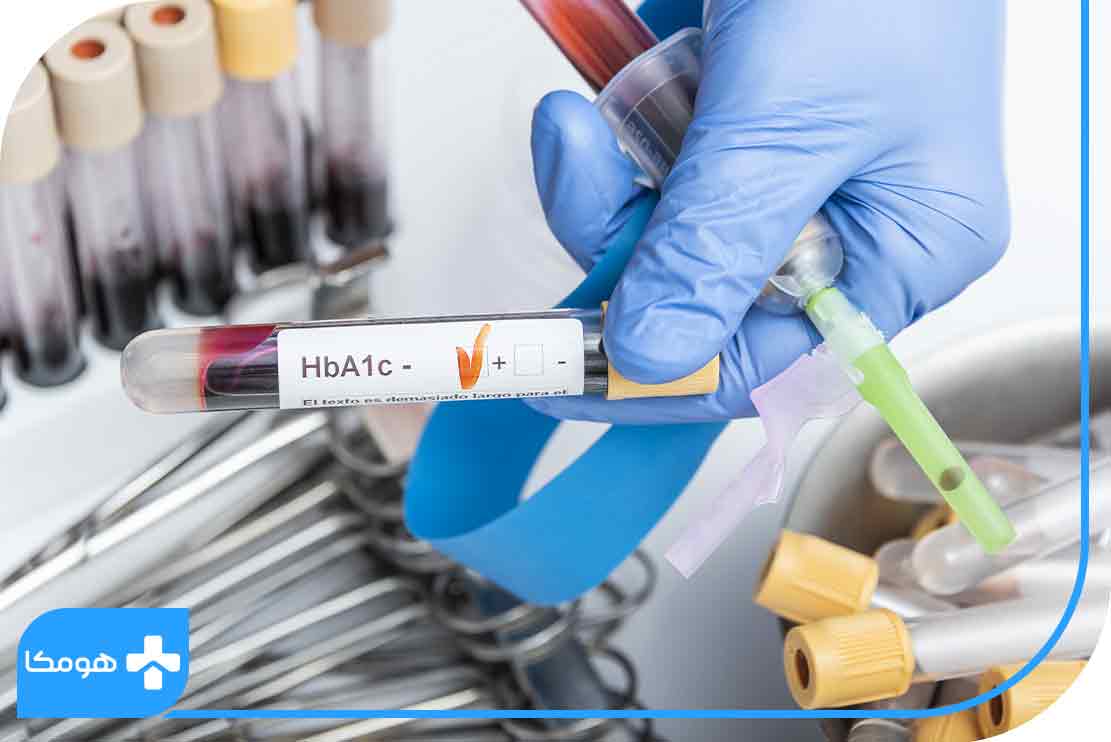 HbA1C در آزمایش خون