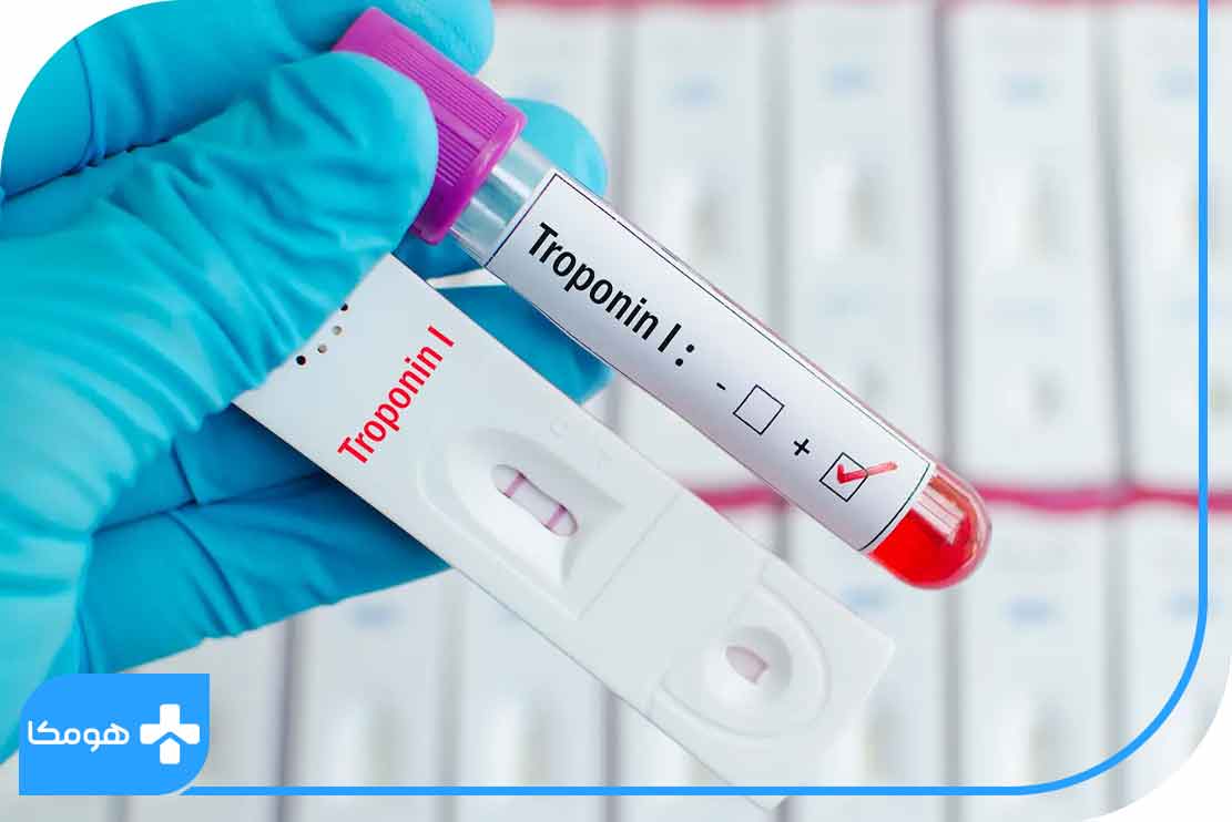 Troponin در آزمایش خون چیست؟