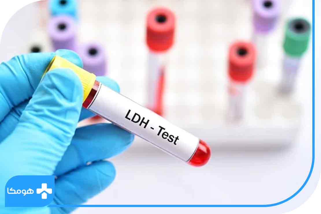 LDH در آزمایش خون