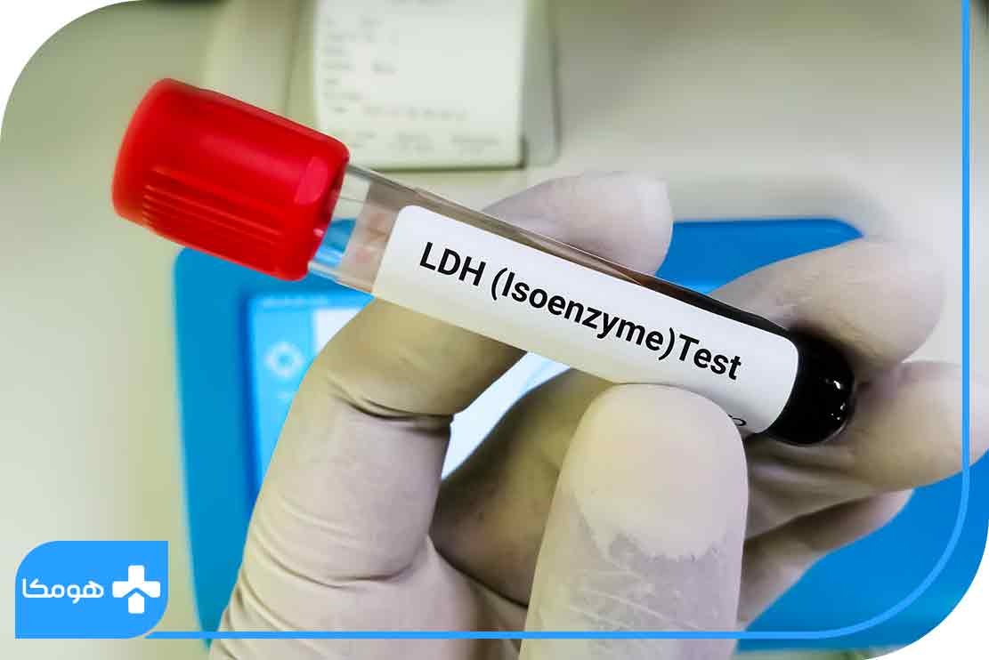 تفسیر آزمایش LDH