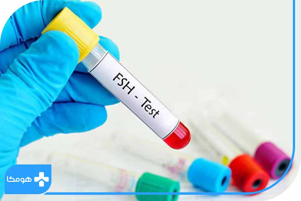 FSH در آزمایش خون چیست؟ 