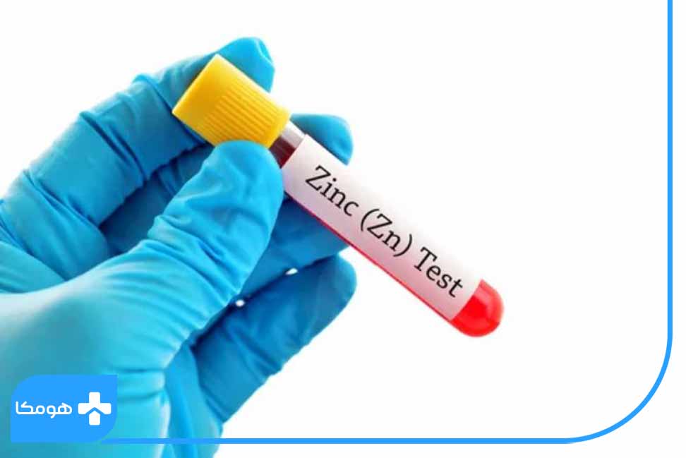 علائم و عوارض بالا بدون Zinc در آزمایش خون
