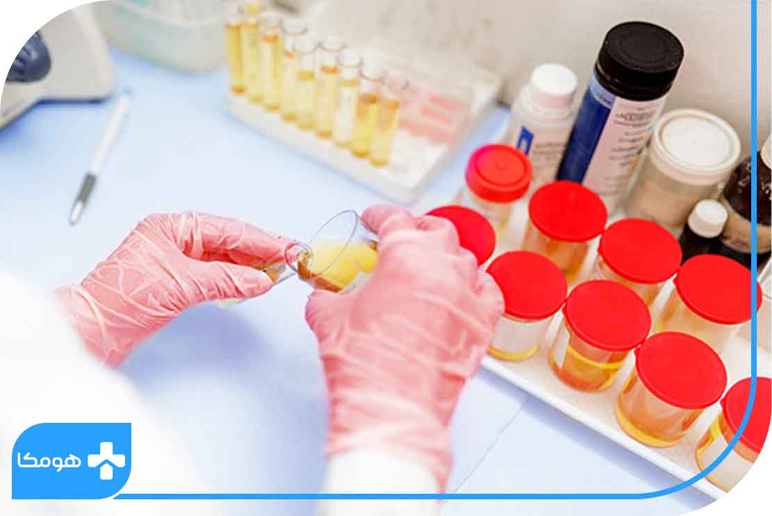 آزمایش کاتکول آمین ادرار چیست؟