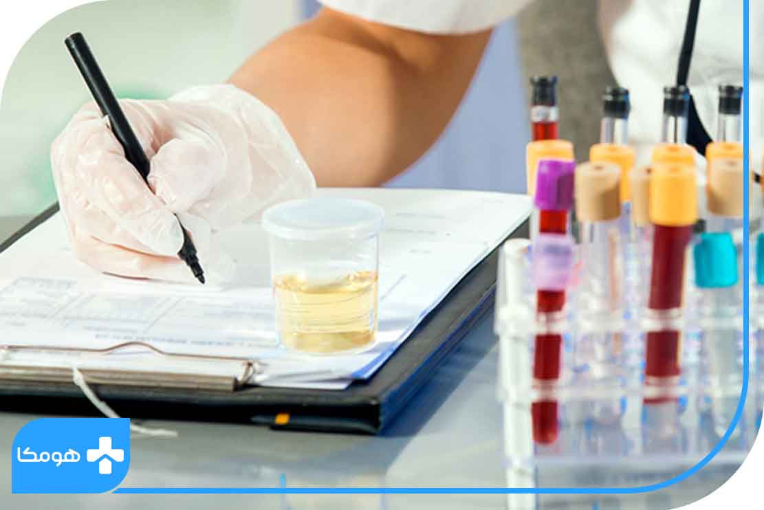 تفسیر کاتکول آمین در آزمایش ادرار