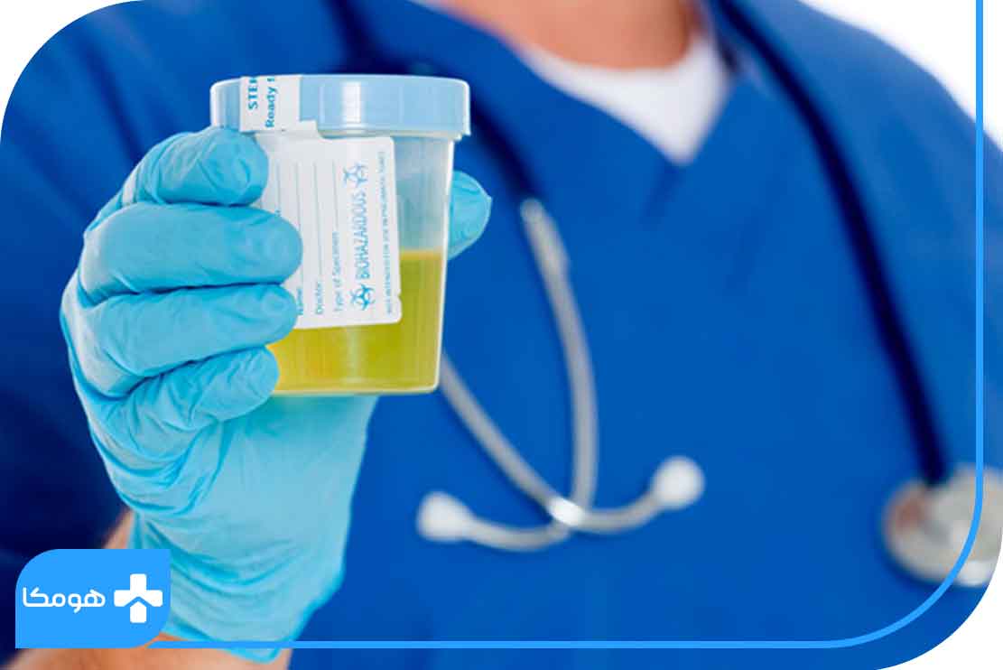 شرایط انجام تست کاتکول آمین ادرار