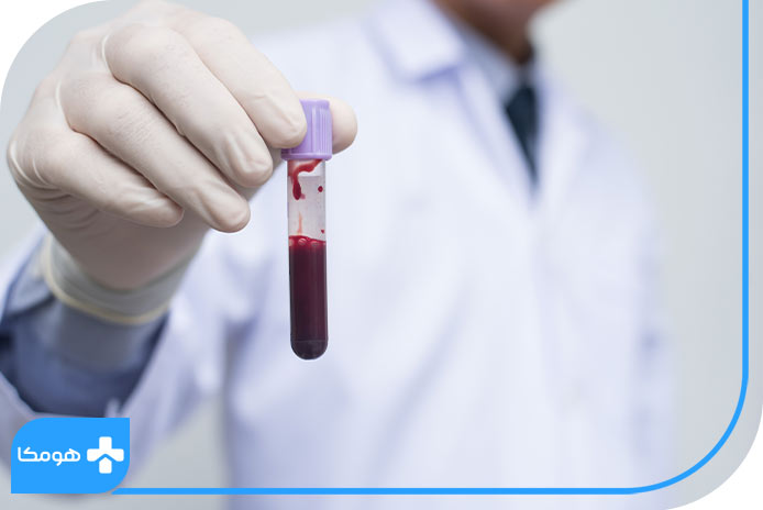 Vit B12 در آزمایش خون چیست؟