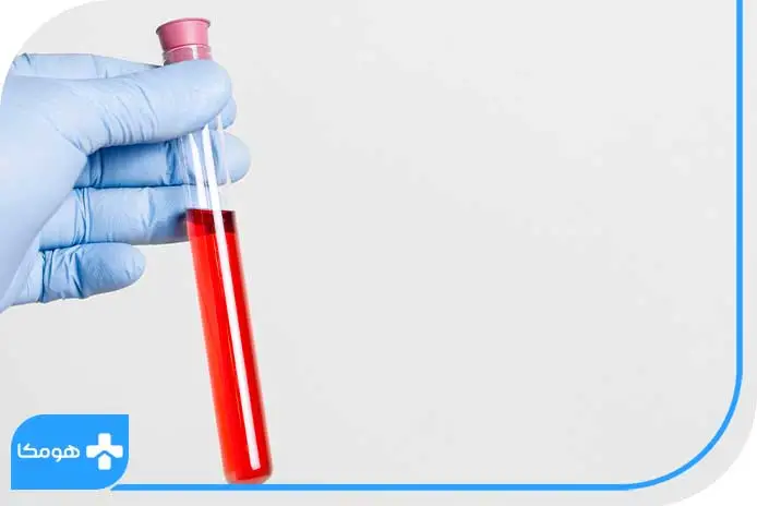 HDL در آزمایش خون چیست؟