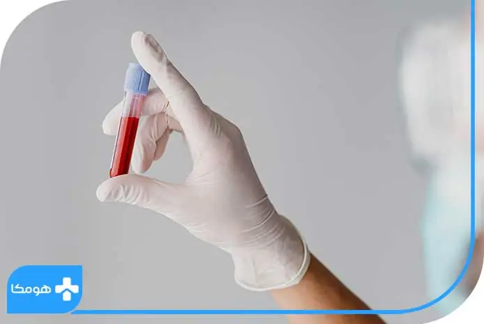 مقدار نرمال HDL در آزمایش خون چقدر است؟