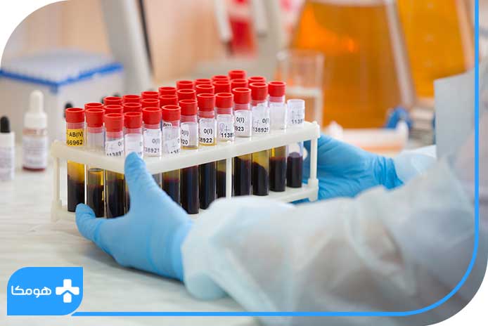 درمان پایین بودن MCH در آزمایش خون