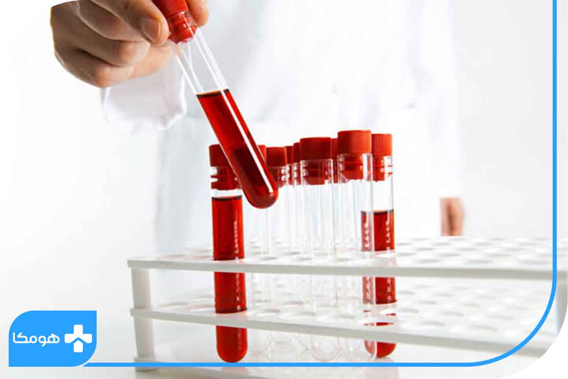 بالا یا پایین بودن SPEP در آزمایش خون