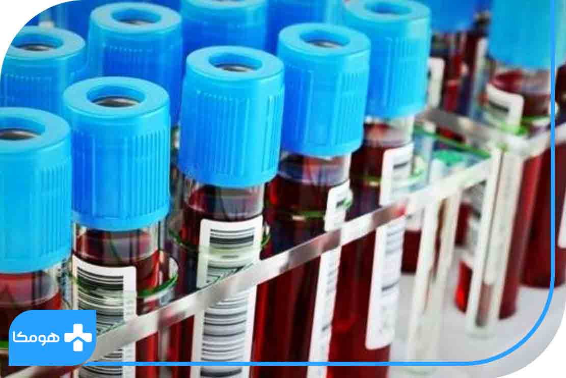آزمایش الکتروفورز پروتئین 