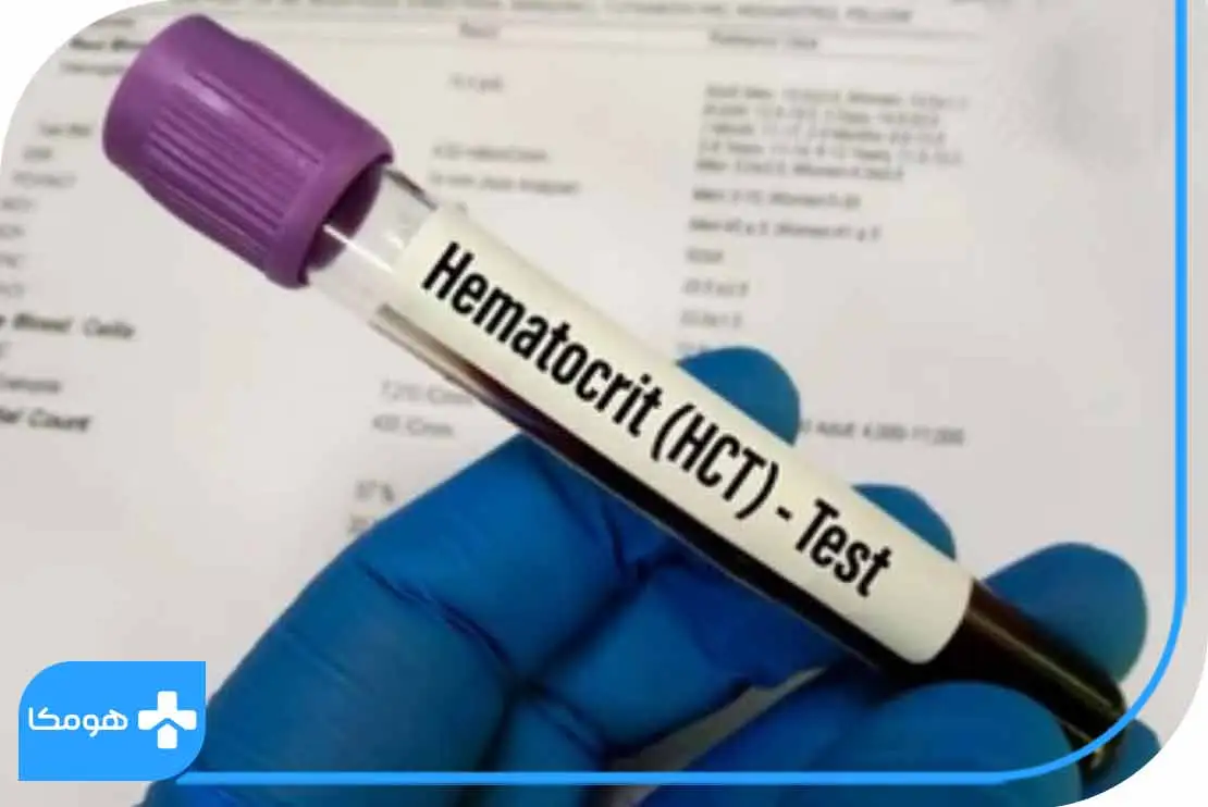 پایین بودن HCT در آزمایش خون 