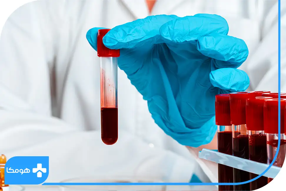 انواع خدمات آزمایش در منزل اصفهان