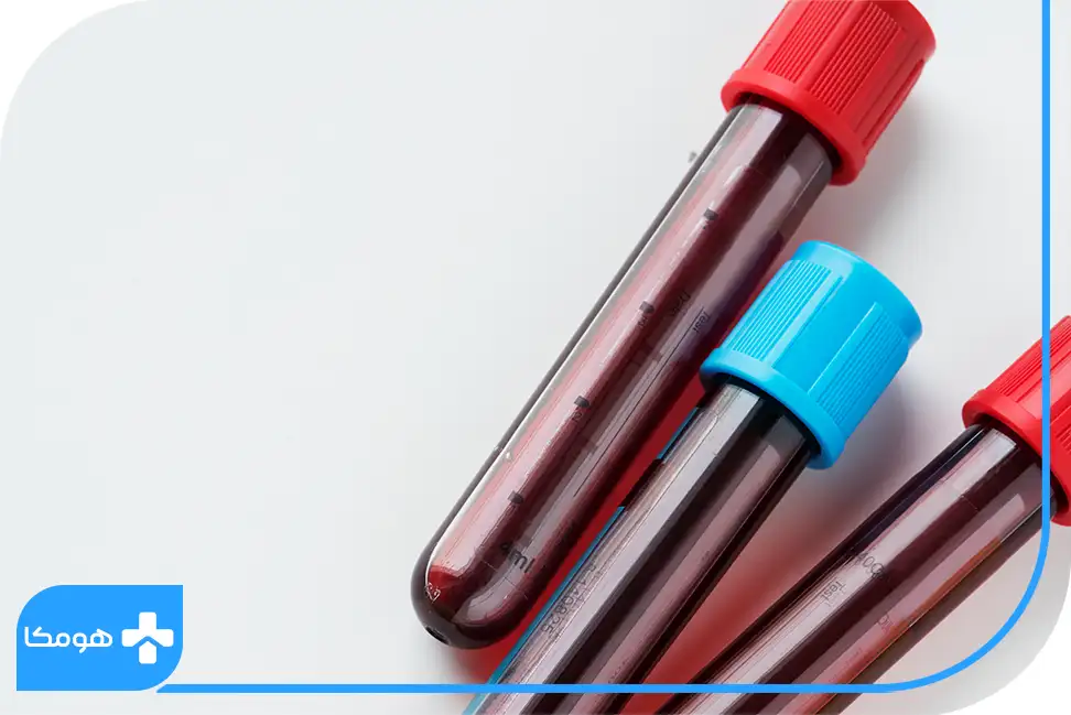دقت خدمات گرفتن آزمایش خون و ادرار در منزل اصفهان