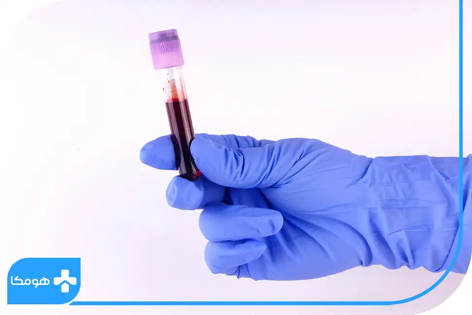 آنالیز جواب آزمایش در منزل اصفهان